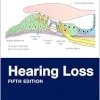 Hearing Loss, 5th Edition (EPUB)