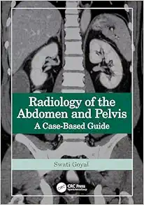 Radiology of the Abdomen and Pelvis: A Case-Based Guide, 1st Edition (Original PDF from Publisher)