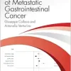 The Prognosis of Metastatic Gastrointestinal Cancer (Original PDF from Publisher)