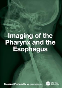 Imaging of the Pharynx and the Esophagus (EPUB)