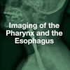 Imaging of the Pharynx and the Esophagus (Original PDF from Publisher)