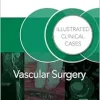 Vascular Surgery: Illustrated Clinical Cases (Original PDF from Publisher)