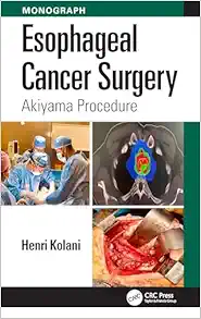 Esophageal Cancer Surgery: Akiyama Procedure (Original PDF from Publisher)