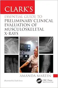 Clark’s Essential Guide to Preliminary Clinical Evaluation of Musculoskeletal X-rays: Evaluating and Commenting on Images (Clark’s Companion Essential Guides) (Original PDF from Publisher)