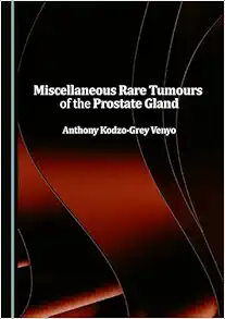 Miscellaneous Rare Tumours of the Prostate Gland (Original PDF from Publisher)