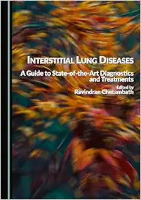 Interstitial Lung Diseases: A Guide to State-of-the-Art Diagnostics and Treatments (Original PDF from Publisher)