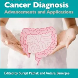 Colorectal Cancer Diagnosis: Advancements and Applications (Original PDF from Publisher)