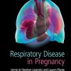 Respiratory Disease in Pregnancy (Original PDF from Publisher)