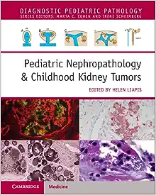 Pediatric Nephropathology & Childhood Kidney Tumors (Diagnostic Pediatric Pathology) (Original PDF from Publisher)