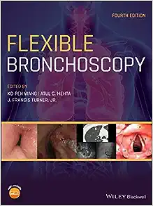 Flexible Bronchoscopy, 4th Edition (EPUB)