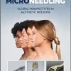 Microneedling: Global Perspectives in Aesthetic Medicine (EPUB)