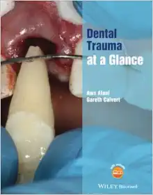 Dental Trauma at a Glance (At a Glance (Dentistry)) (Original PDF from Publisher)