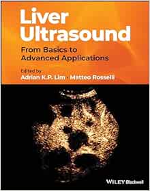 Liver Ultrasound: From Basics to Advanced Applications (Original PDF from Publisher)