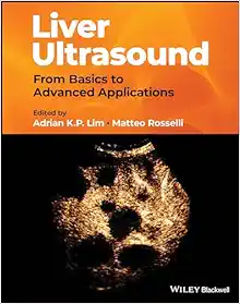 Liver Ultrasound: From Basics to Advanced Applications (EPUB)