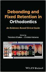 Debonding and Fixed Retention in Orthodontics: An Evidence-Based Clinical Guide (Original PDF from Publisher)