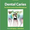 Dental Caries: The Disease and its Clinical Management, 4th Edition (EPUB)