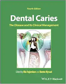 Dental Caries: The Disease and its Clinical Management, 4th Edition (EPUB)