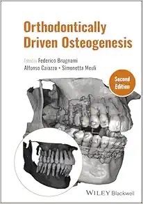Orthodontically Driven Osteogenesis, 2nd Edition (EPUB)