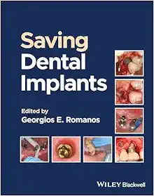 Saving Dental Implants (Original PDF from Publisher)