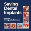 Saving Dental Implants (EPUB)