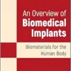 An Overview of Biomedical Implants: Biomaterials for the Human Body (Original PDF from Publisher)