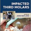 Impacted Third Molars, 2nd Edition (EPUB)