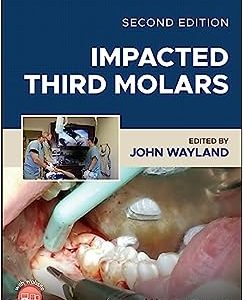 Impacted Third Molars, 2nd Edition (Original PDF from Publisher)