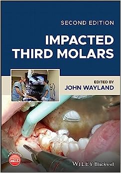Impacted Third Molars, 2nd Edition (Original PDF from Publisher)