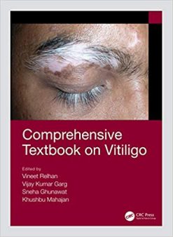 Comprehensive Textbook on Vitiligo (Original PDF From Publisher)