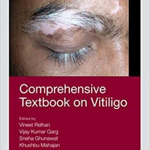 Comprehensive Textbook on Vitiligo (Original PDF From Publisher)
