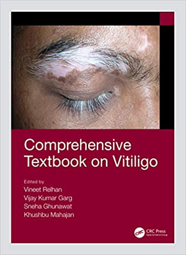 Comprehensive Textbook on Vitiligo (Original PDF From Publisher)