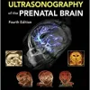 Timor’s Ultrasonography of the Prenatal Brain, 4th Edition (EPUB)