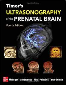 Timor’s Ultrasonography of the Prenatal Brain, 4th edition (Original PDF from Publisher)