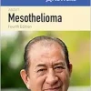 100 Questions & Answers About Mesothelioma, 4th Edition (Original PDF from Publisher)