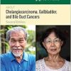 100 Questions & Answers About Cholangiocarcinoma, Gallbladder, and Bile Duct Cancers, 2nd Edition (Original PDF from Publisher)
