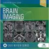 Brain Imaging: Case Review Series, 3rd edition (ePub+Converted PDF)