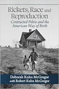 Rickets, Race and Reproduction: Contracted Pelvis and the American Way of Birth (Original PDF from Publisher)