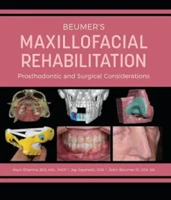 Beumer’s Maxillofacial Rehabilitation: Prosthodontics and Surgical Considerations (AZW3 + EPUB)