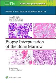 Biopsy Interpretation of the Bone Marrow (Biopsy Interpretation Series) (EPUB)