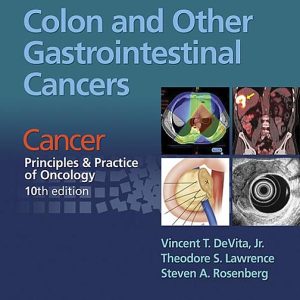 Colon and Other Gastrointestinal Cancers: Cancer: Principles & Practice of Oncology, 10th edition (EPUB)