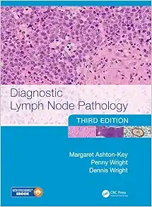 Diagnostic Lymph Node Pathology (Original PDF from Publisher)
