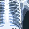 X-ray (Object Lessons) (EPUB)