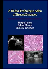 A Radio-Pathologic Atlas of Breast Diseases (Original PDF from Publisher)