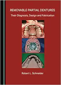 Removable Partial Dentures: Their Diagnosis, Design and Fabrication (Original PDF from Publisher)