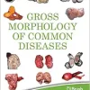 Gross Morphology of Common Diseases (EPUB)