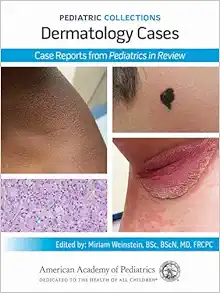 Pediatric Collections: Dermatology Cases: Case Reports from Pediatrics in Review (Original PDF from Publisher)