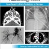 Pediatric Collections: Pulmonology Cases: Case Reports from Pediatrics in Review (Original PDF from Publisher)