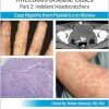 Pediatric Collections: Infectious Disease Cases: Part 2: Indolent Head Scratchers (Original PDF from Publisher)
