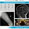 Pediatric Collections: Endocrinology Cases: Case Reports from Pediatrics in Review (Original PDF from Publisher)