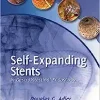 Self-Expanding Stents in Gastrointestinal Endoscopy (Original PDF from Publisher)